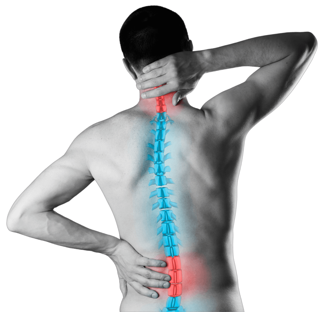 Neck and lower back spondylosis