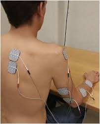 Electrical stimulation therapy